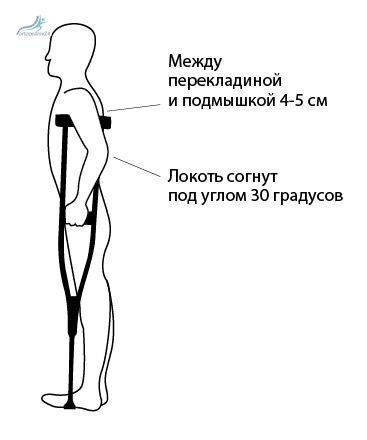 Костыль под колено своими руками чертежи